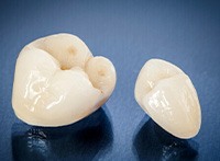 A close-up of two ceramic dental crowns