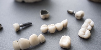 metal-free restorations arranged on a counter