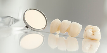 crowns sitting on counter