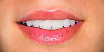 photo of women's smile