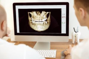 Dentist reviewing computer image for dental implants.