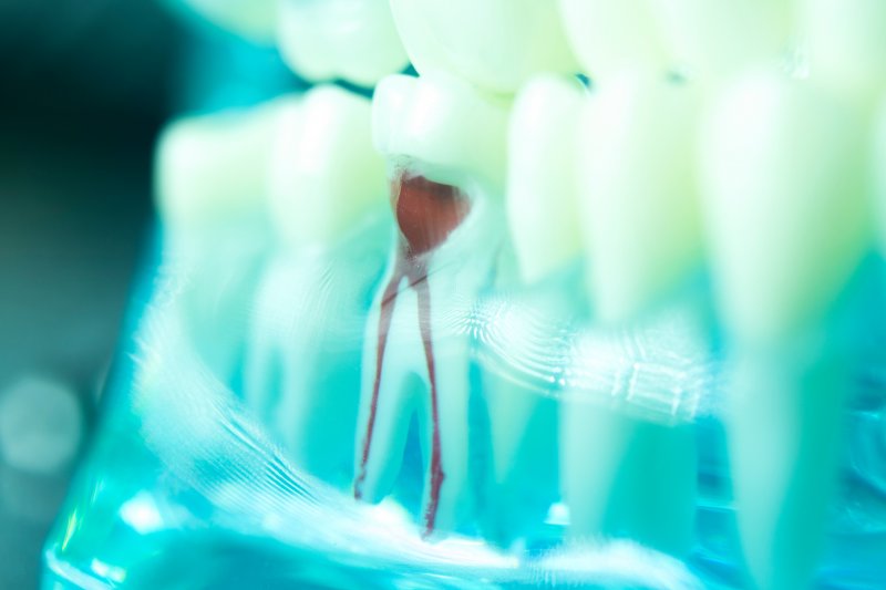 model of the inside of a tooth
